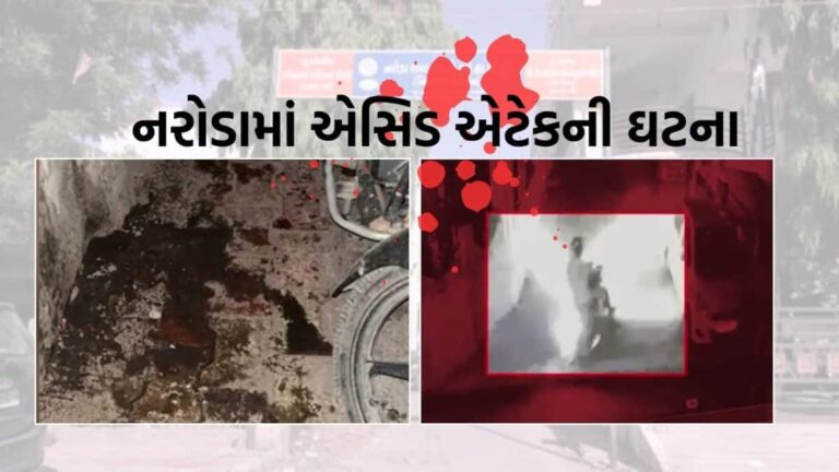 અમદાવાદના નરોડામાં યુવતી પર એસિડ એટેક, પિતાની સંડોવણીની આશંકા | અમદાવાદ
